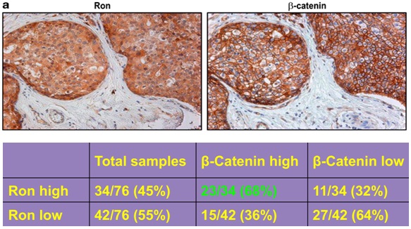 waltz_research_focus_breast_cancer waltz_research_focus_breast_cancer