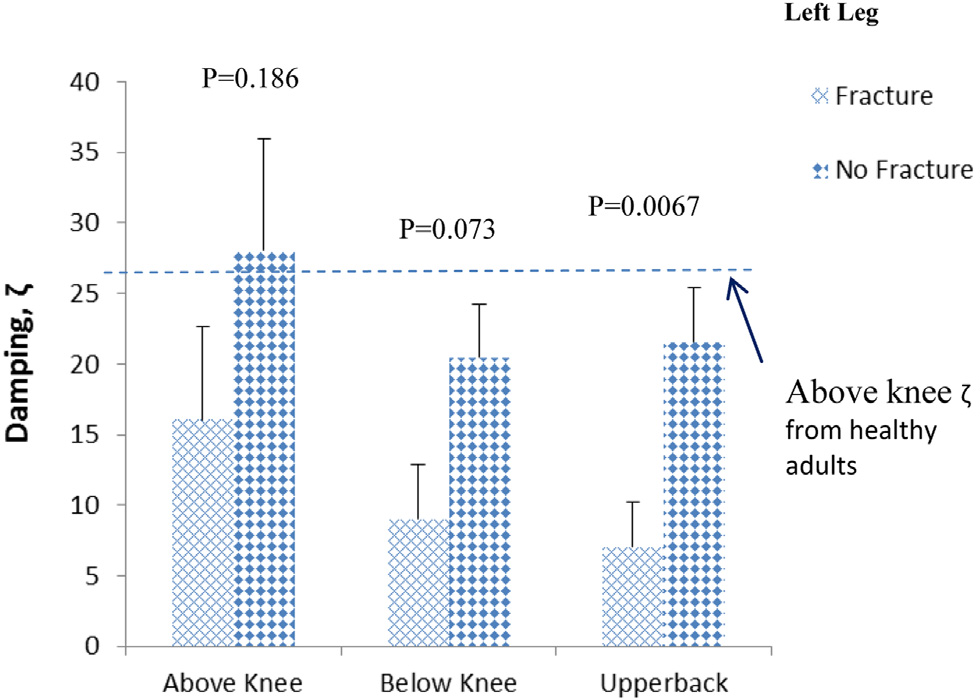 A bar chart showing Above Knee, Below Knee, and Upper Back measurements of patients with osteoporosis showing a lower damping level for patients with a fracture versus without a fracture