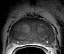 verma-fig-2aresized